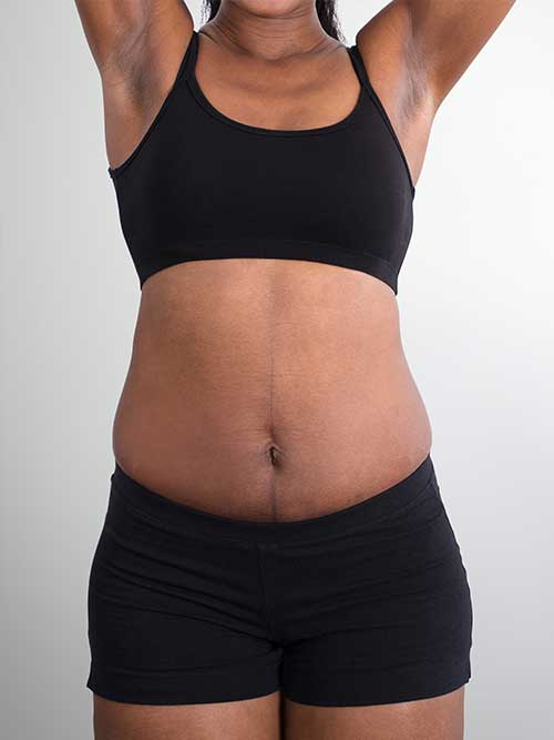 body-5